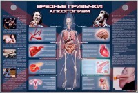 Электрифицированный стенд "Вредные привычки: алкоголизм" - fgospostavki.ru - Яблоновский