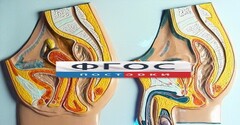 Модель барельефная "Таз мужской и таз женский" - fgospostavki.ru - Яблоновский