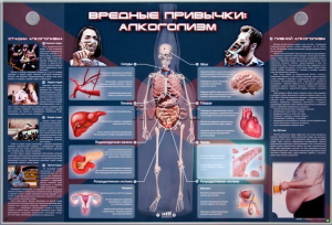Электрифицированный стенд "Вредные привычки: алкоголизм" - fgospostavki.ru - Яблоновский